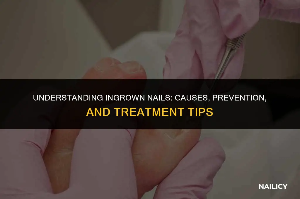 how can you get ingrown nails