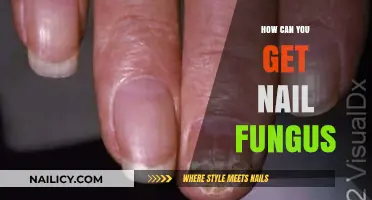 Understanding Nail Fungus: Causes, Symptoms, and Prevention Tips