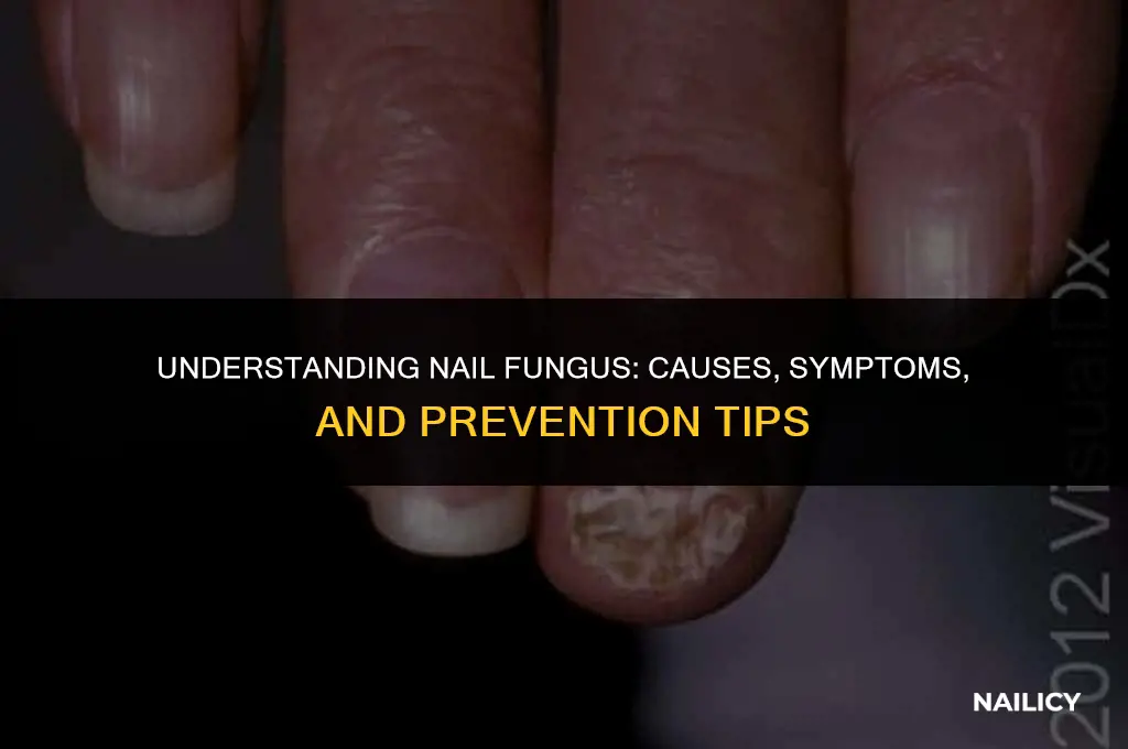 how can you get nail fungus