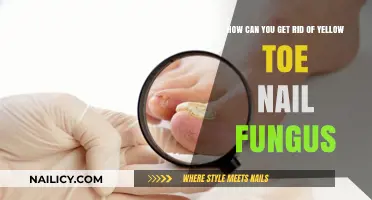 Effective Remedies to Eliminate Yellow Toenail Fungus Fast