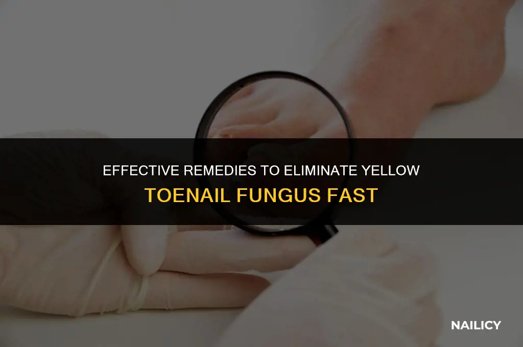 how can you get rid of yellow toe nail fungus