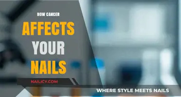 Cancer's Impact: Understanding Nail Changes and What They Signal