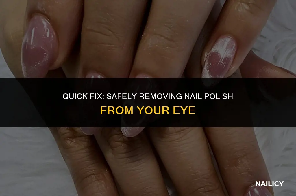 how cannyou get nail polisj out of your eye