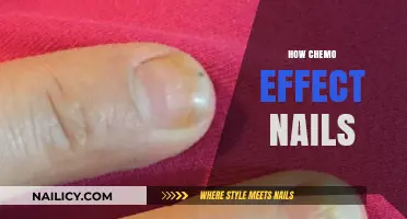Chemotherapy’s Impact: Understanding How Chemo Affects Your Nails