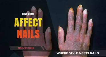 How Chemotherapy Impacts Nail Health: Causes, Effects, and Care Tips