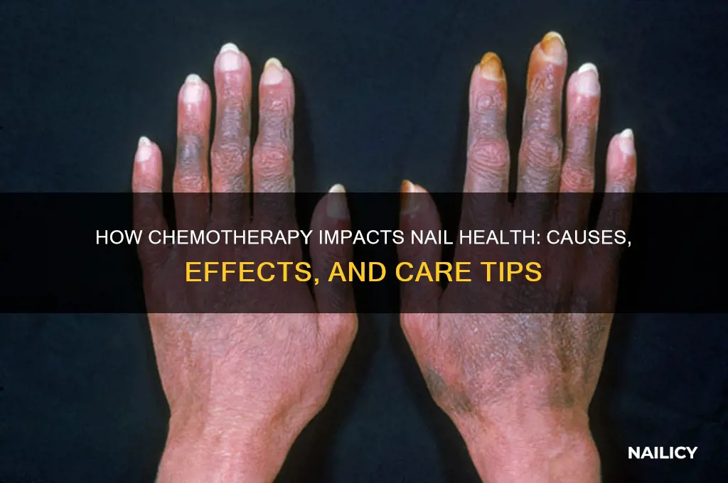 how chimo affect nails
