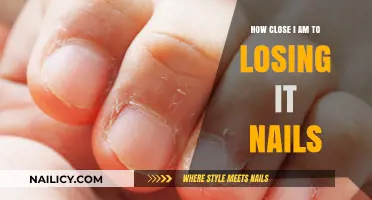 Nail-Biting Reality: My Close Call with Losing It All