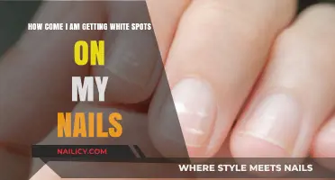 Uncover the Mystery: Why White Spots Appear on Your Nails