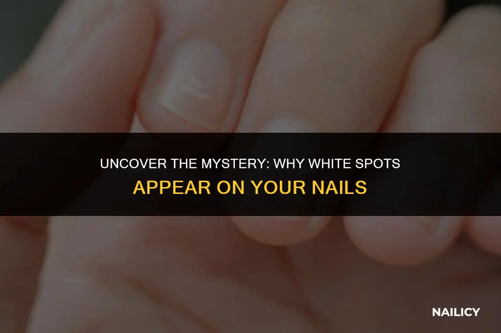 how come i am getting white spots on my nails