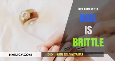 Why Are My Nails Brittle? Causes and Solutions for Stronger Nails
