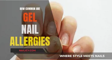 Gel Nail Allergies: Are They Common or Rare?