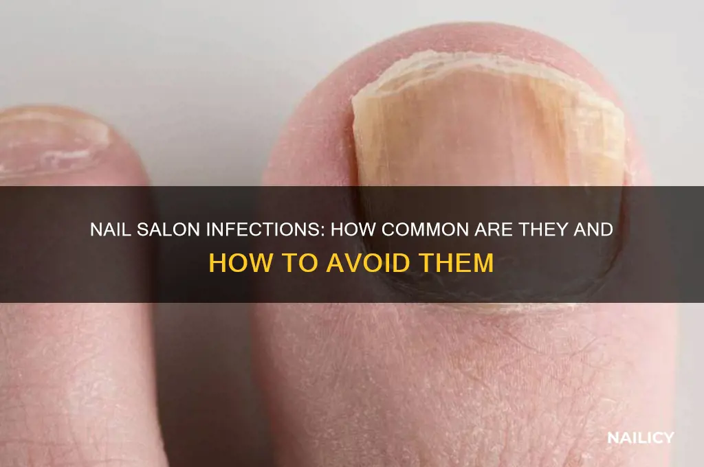 how common are nail infections from nail salon