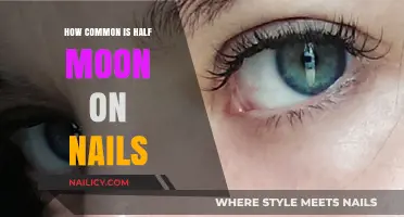 Half Moons on Nails: Frequency, Causes, and What They Mean