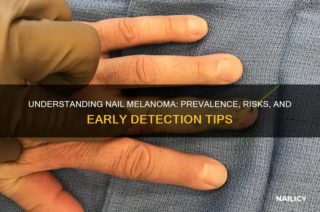 how common is nail melanoma
