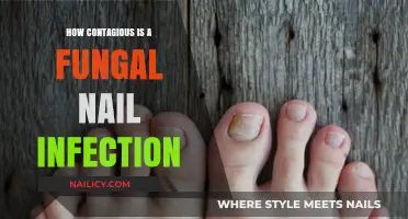 Is Your Fungal Nail Infection Contagious? Spread Risks Explained