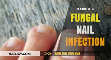 Understanding Fungal Nail Infections: Causes, Symptoms, and Treatments