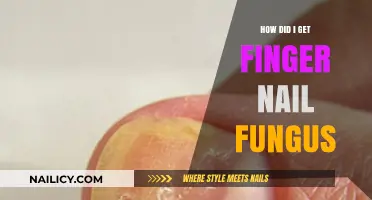 Understanding the Causes: How I Got Fingernail Fungus
