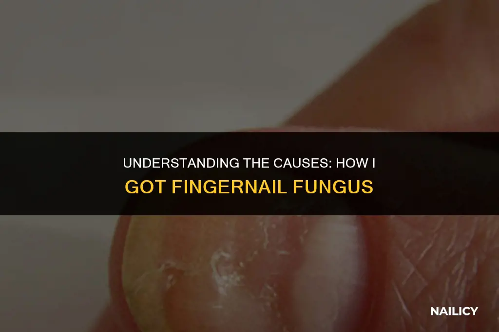 how did i get finger nail fungus