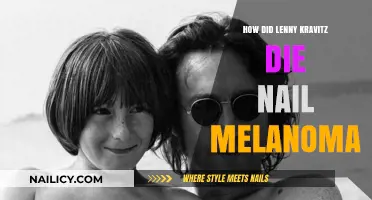 Lenny Kravitz Nail Melanoma Myth Debunked: Separating Fact from Fiction