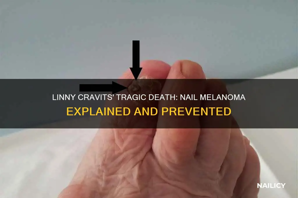 how did linny cravits die nail melanoma