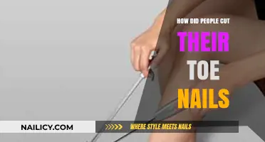 Toenail Cutting: A Historical Perspective