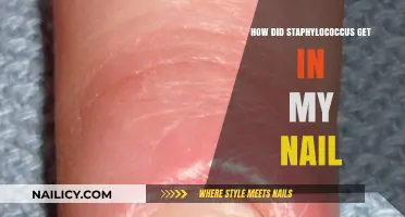 Unraveling the Mystery: How Staphylococcus Infects Your Nails