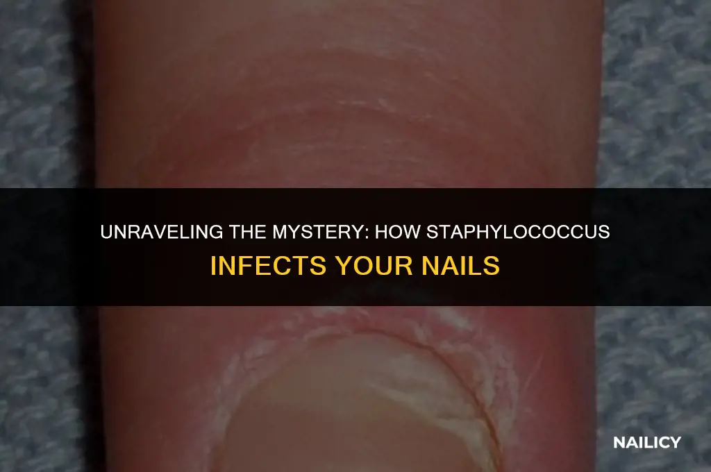 how did staphylococcus get in my nail