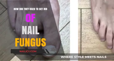 Ancient Remedies: How Our Ancestors Battled Nail Fungus