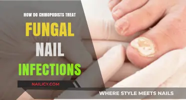 Effective Chiropody Treatments for Fungal Nail Infections: Expert Care Explained