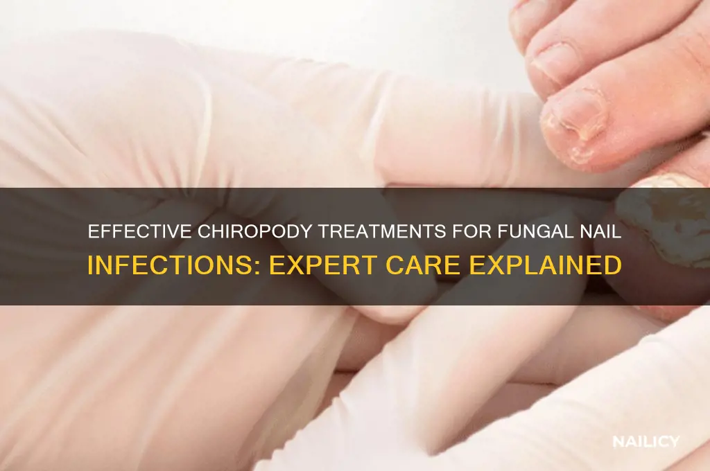 how do chiropodists treat fungal nail infections