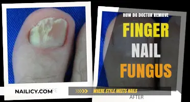 Eradicating Nail Fungus: Medical Procedures and Treatments
