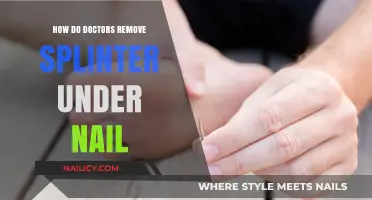 Expert Splinter Removal: Nail-Embedded Cases