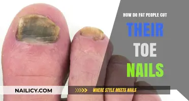 Challenges of Toenail Cutting for Overweight People
