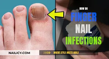 Nail Infections: Understanding the Causes, Symptoms, and Treatment Options