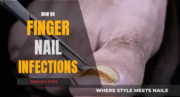 Battling Nail Infections: Keeping Your Fingers Healthy
