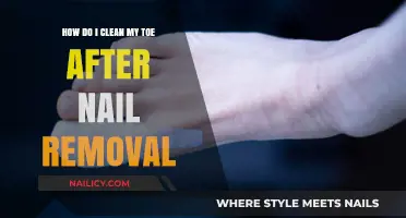 Toe Care: Post-Nail Removal Cleaning Guide