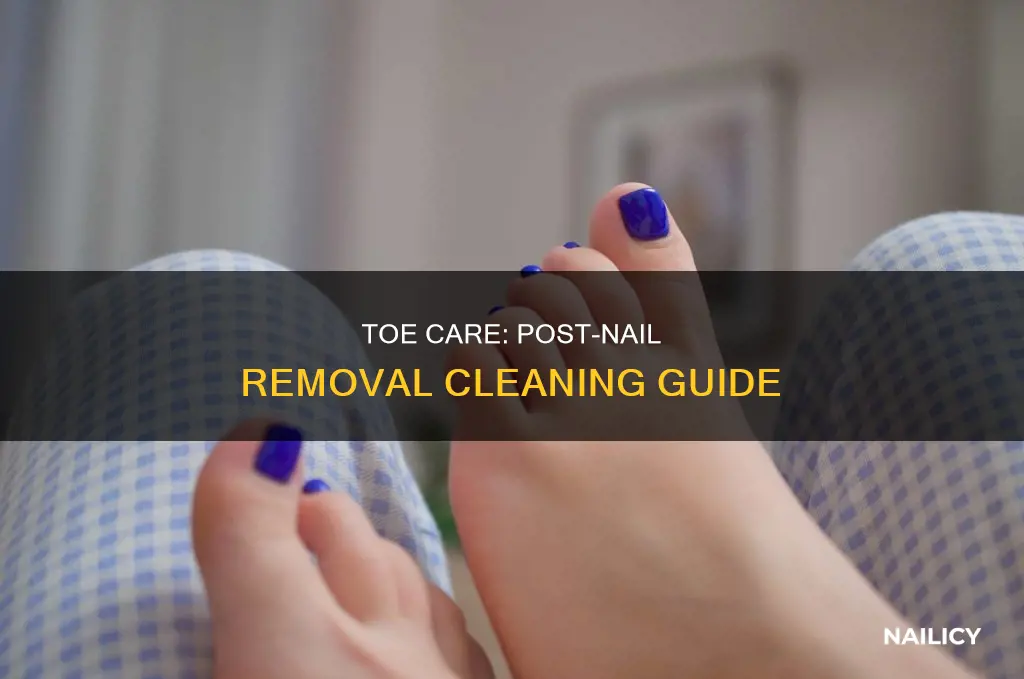 how do i clean my toe after nail removal