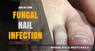 Effective Remedies to Cure Fungal Nail Infections and Restore Healthy Nails