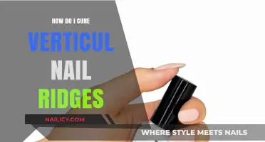 Effective Ways to Treat and Smooth Vertical Nail Ridges Naturally