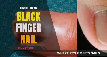 Treating Black Fingernails: A Quick Home Remedy Guide