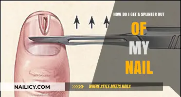 Ouch! Splinter in Your Nail? Here's How to Get It Out Safely