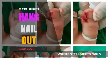 Ouch! How to Safely Remove a Painful Toe Hangnail at Home