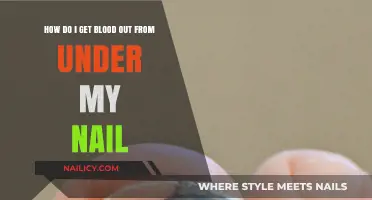 Quick Fix: Removing Blood from Under Your Nail