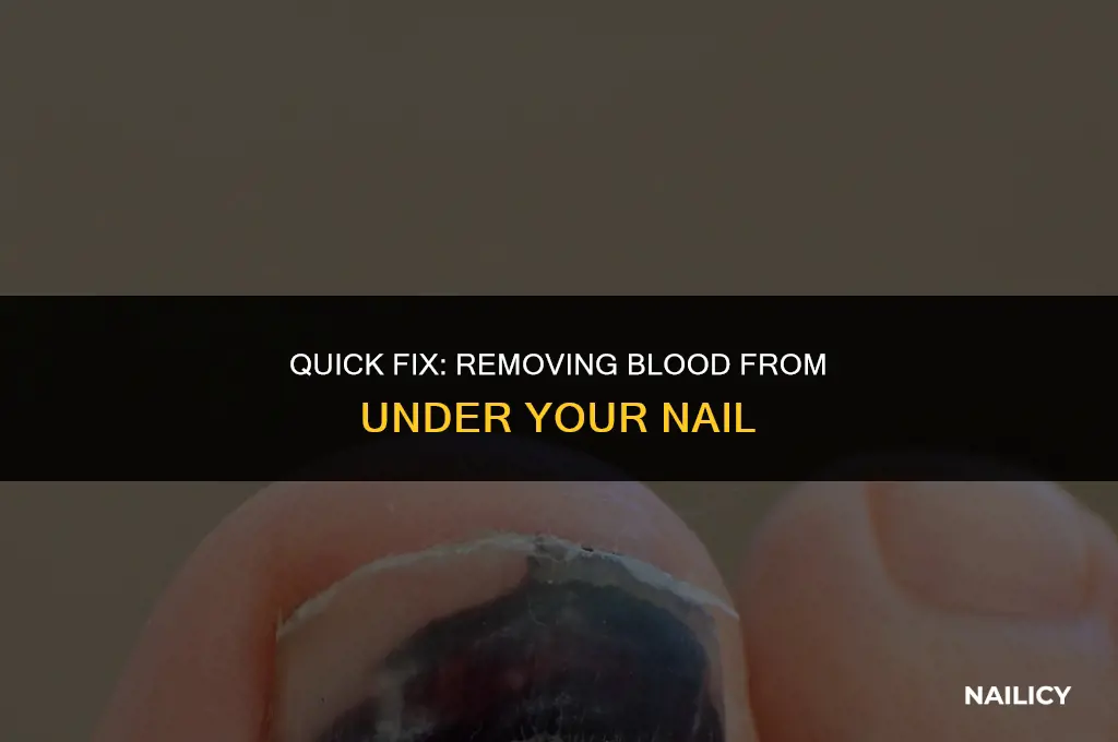 how do i get blood out from under my nail
