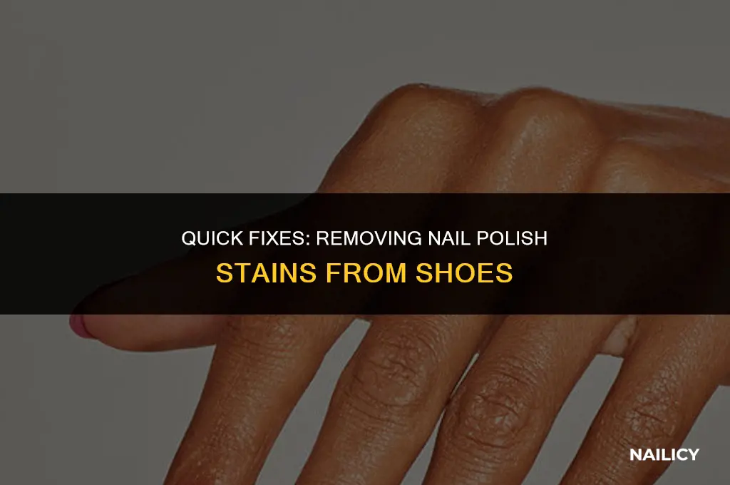how do i get nail polish out of my shoes