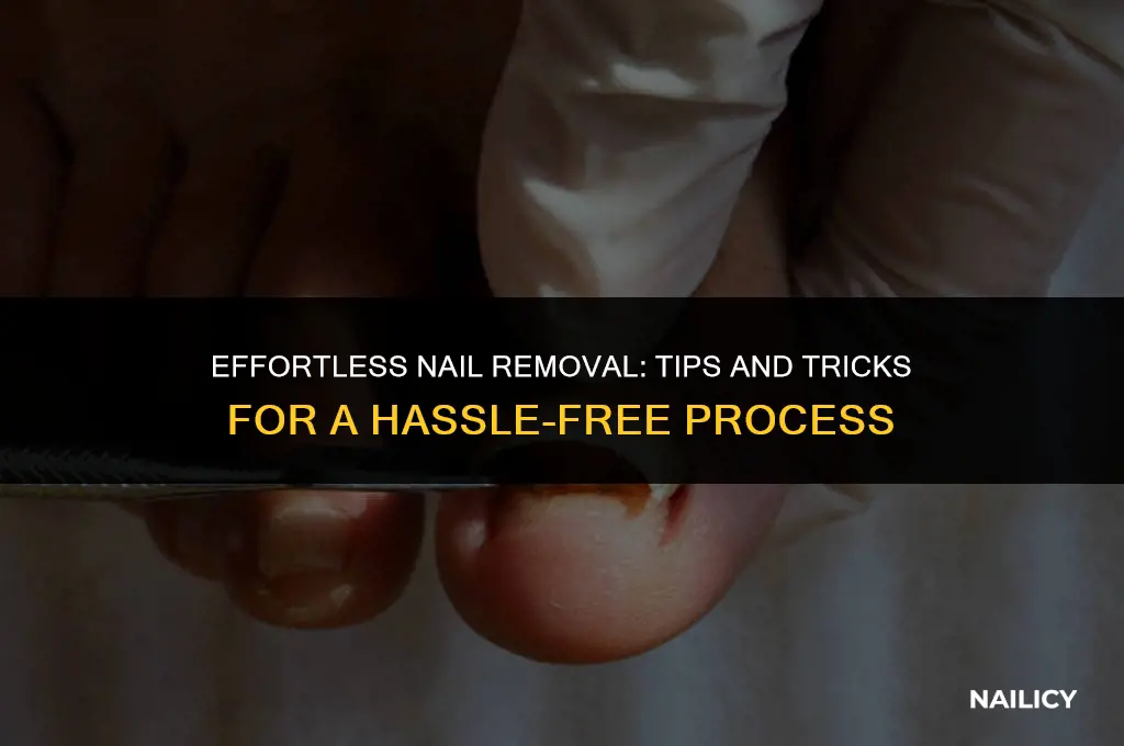 how do i get nails off