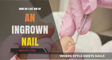 Effective Remedies to Treat and Prevent Ingrown Nails