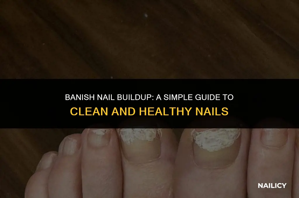 how do i get rid of buildup under nails