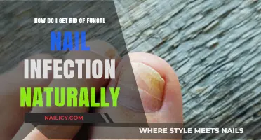 Natural Remedies to Cure Fungal Nail Infections: A Comprehensive Guide