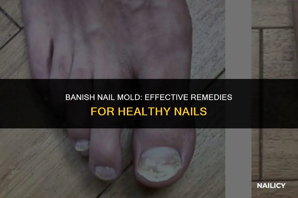 how do i get rid of mold on my nails